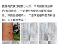 吉林医院最新爆料消息,揭秘重大医疗事件真相